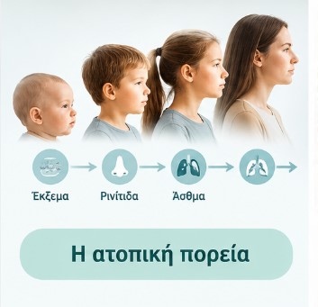 Η ατοπική πορεία